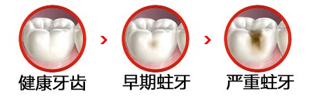 成年人一颗牙齿坏了怎么办？